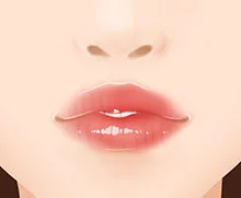 Incomplete Lip Closure