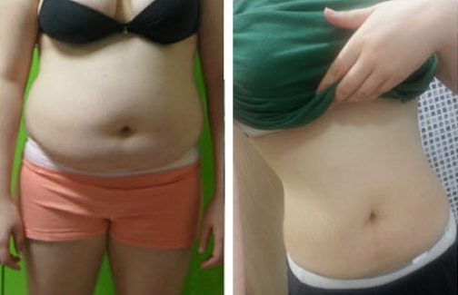 Eddie’s Plastic Surgery Real Review