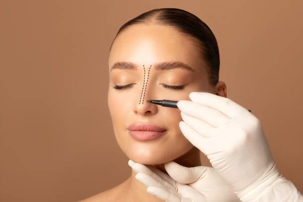 Emergency Guide to Broken Nose Reconstruction: Restoration and Recovery