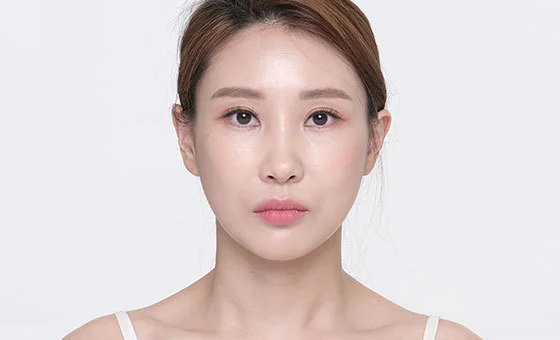Face contour revision after
