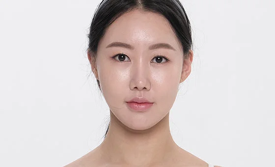 Face contour revision after