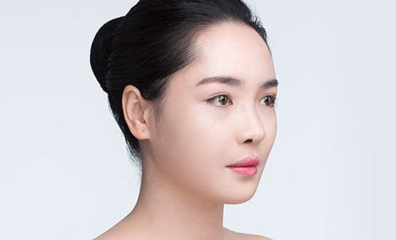 Protruding mouth correction after