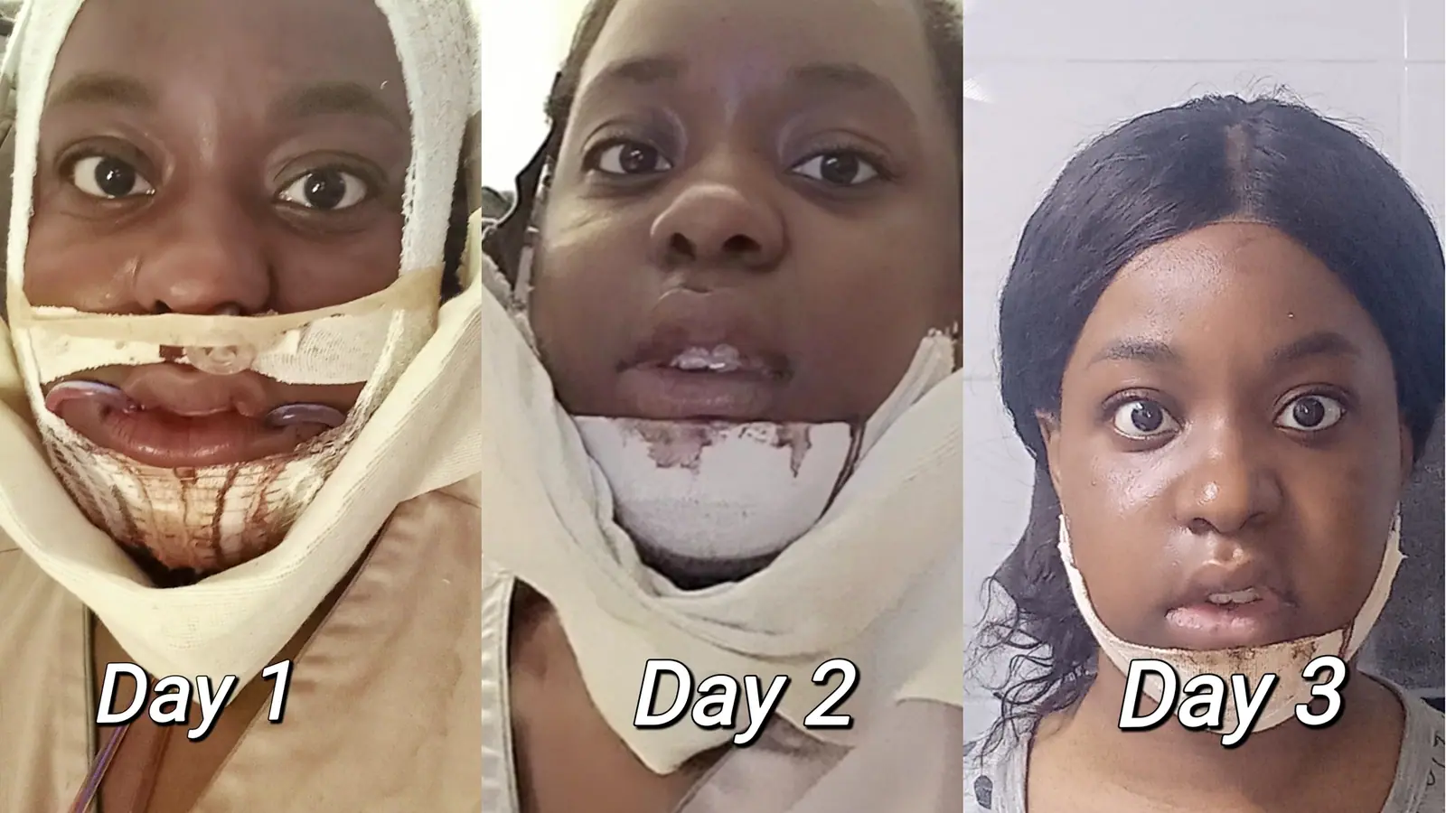 MYO’s Plastic Surgery Real Review. — Myos Review.audit