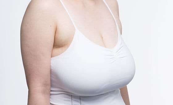 Reduction — Before