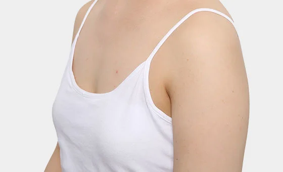 Augmentation — Before