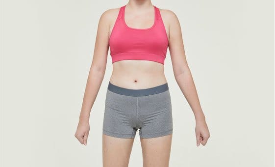 Body liposuction after