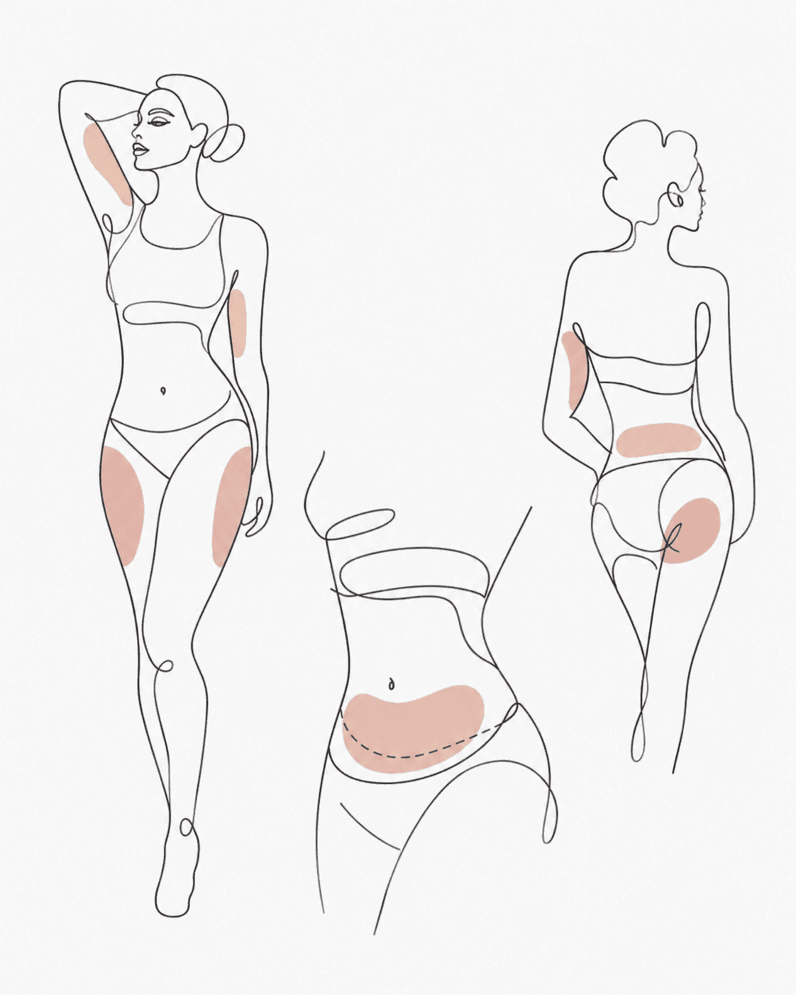 Line illustration of the body areas treated at Banobagi, with the arms, flanks, abdomen, thighs and buttocks highlighted