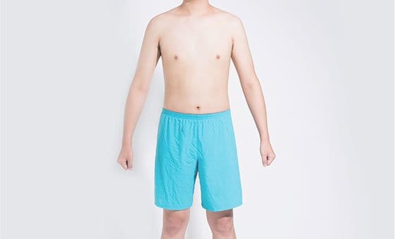 Body liposuction after